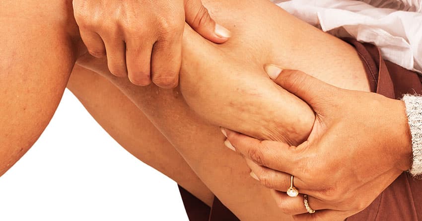 SELÜLİT BAKIMI LÜKS DEĞİL İHTİYAÇTIR