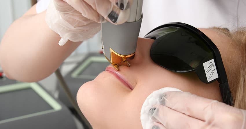 LAZER EPİLASYON YAPTIRMAK İÇİN EN İYİ 5 NEDEN