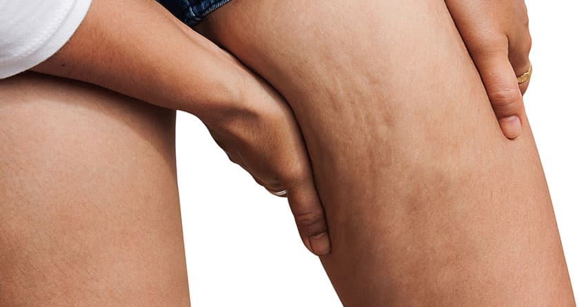 KIZILAY SELÜLİT BAKIMI