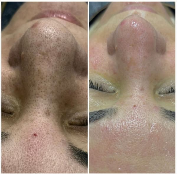 Marshmallow Beauty Studio - 14. Fotoğraf