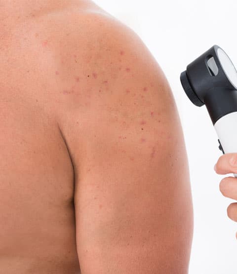 Özel Elos Lazer Polikliniği - 17. Fotoğraf Özel Elos Lazer Polikliniği - 17. Fotoğraf