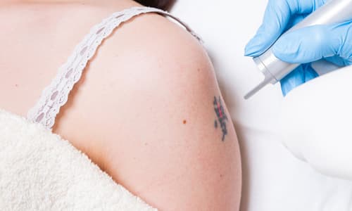 Özel Elos Lazer Polikliniği - 6. Fotoğraf Özel Elos Lazer Polikliniği - 6. Fotoğraf