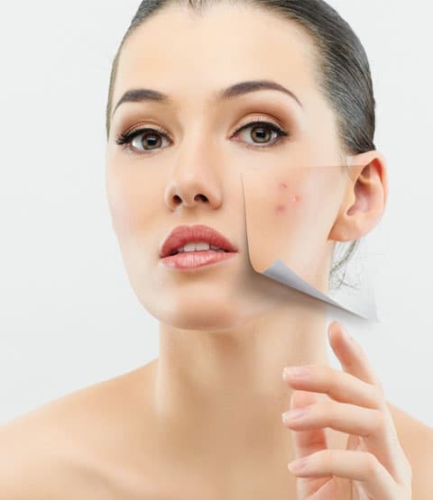 Özel Elos Lazer Polikliniği - Ankara Selülit Bakımı - 4. Fotoğraf