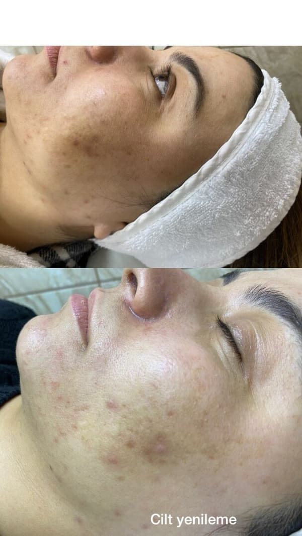 Sıla Zengin Güzellik Salonu - 71. Fotoğraf Sıla Zengin Güzellik Salonu - 71. Fotoğraf