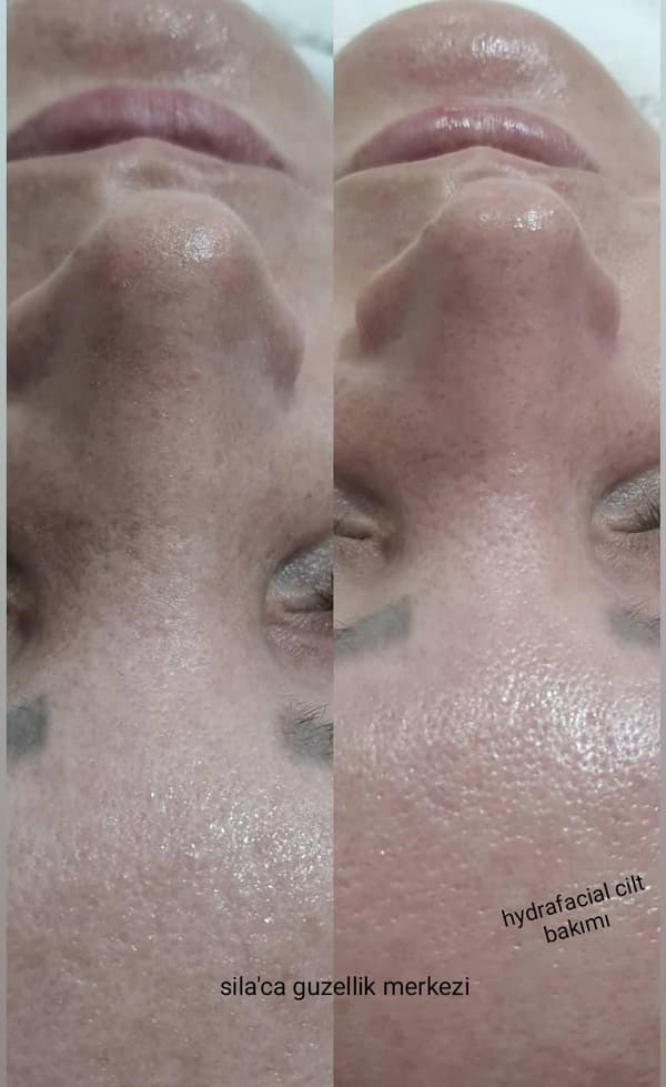 Sıla Zengin Güzellik Salonu - 35. Fotoğraf Sıla Zengin Güzellik Salonu - 35. Fotoğraf