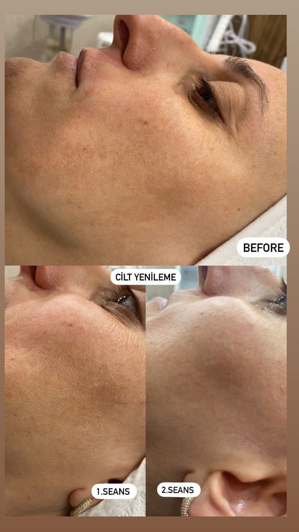 Sıla Zengin Güzellik Salonu - 154. Fotoğraf Sıla Zengin Güzellik Salonu - 154. Fotoğraf