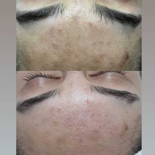 Sıla Zengin Güzellik Salonu - 14. Fotoğraf
