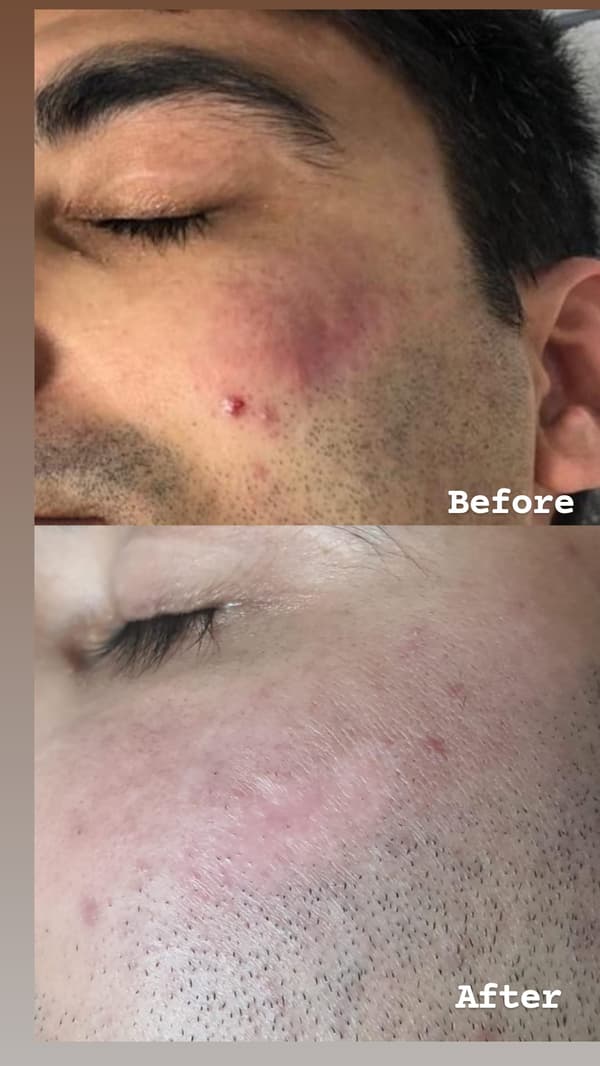 Sıla Zengin Güzellik Salonu - 15. Fotoğraf Sıla Zengin Güzellik Salonu - 15. Fotoğraf