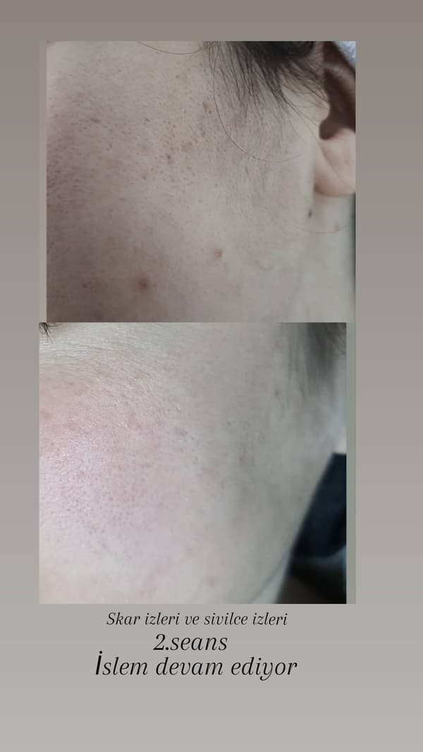 Sıla Zengin Güzellik Salonu - 17. Fotoğraf Sıla Zengin Güzellik Salonu - 17. Fotoğraf