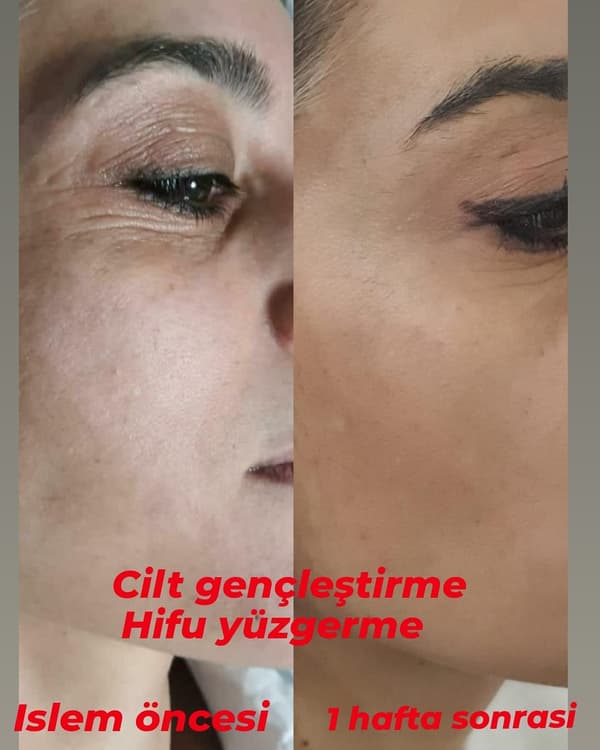 Sıla Zengin Güzellik Salonu - 13. Fotoğraf
