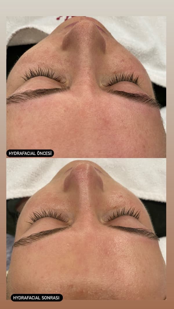 Sıla Zengin Güzellik Salonu - 153. Fotoğraf Sıla Zengin Güzellik Salonu - 153. Fotoğraf