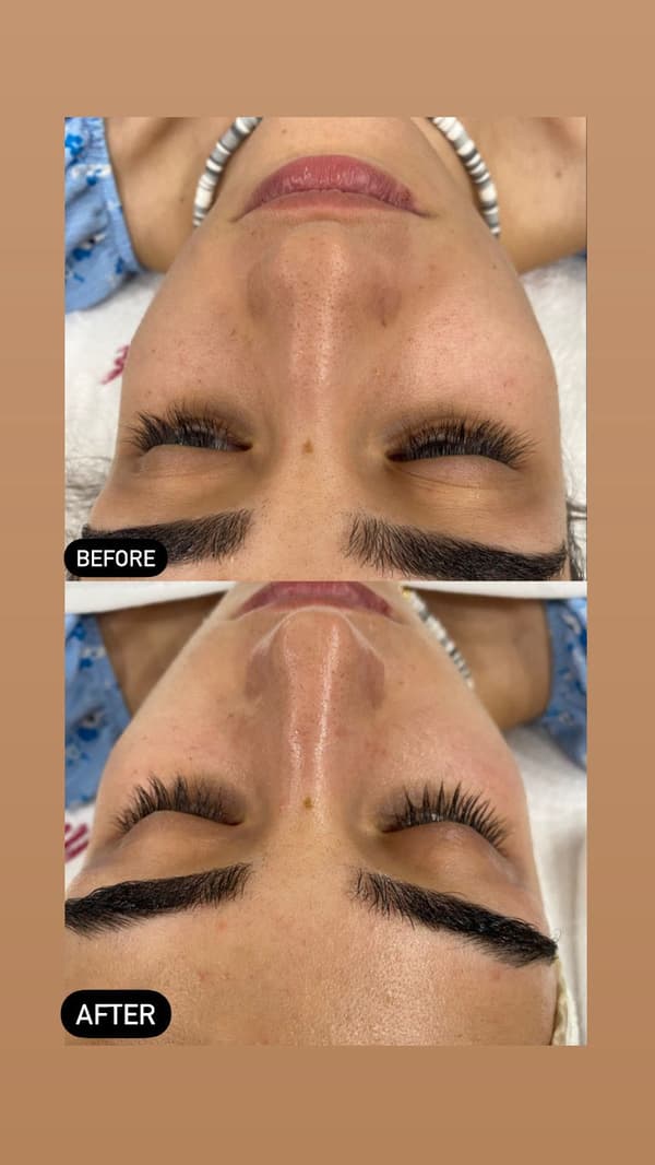 Sıla Zengin Güzellik Salonu - 148. Fotoğraf Sıla Zengin Güzellik Salonu - 148. Fotoğraf