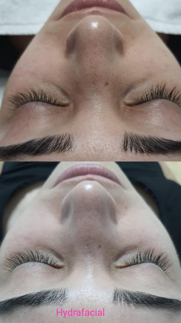 Sıla Zengin Güzellik Salonu - 19. Fotoğraf Sıla Zengin Güzellik Salonu - 19. Fotoğraf