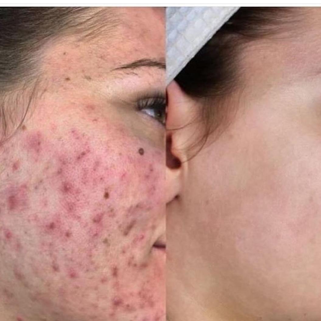 Yeliz Gazeloğlu Beauty Center - GOP Güzellik Merkezleri - 2. Fotoğraf