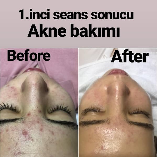 Yeliz Gazeloğlu Beauty Center - 80. Fotoğraf