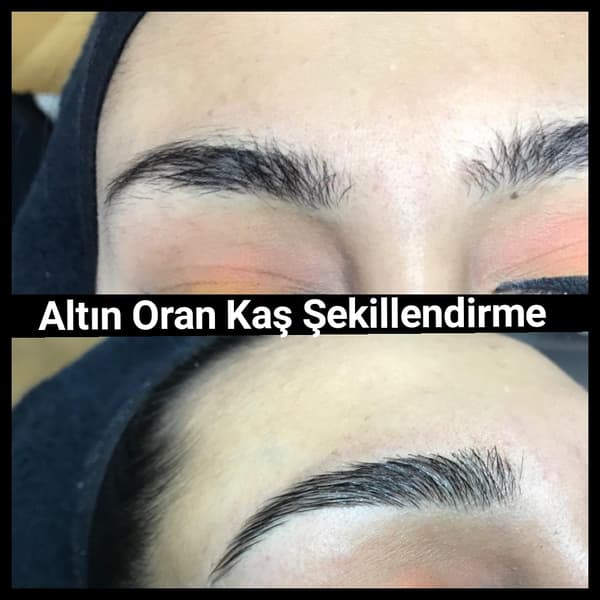 Yeliz Gazeloğlu Beauty Center - 71. Fotoğraf