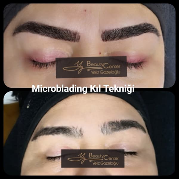 Yeliz Gazeloğlu Beauty Center - 57. Fotoğraf