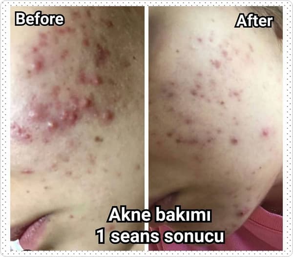 Yeliz Gazeloğlu Beauty Center - 76. Fotoğraf
