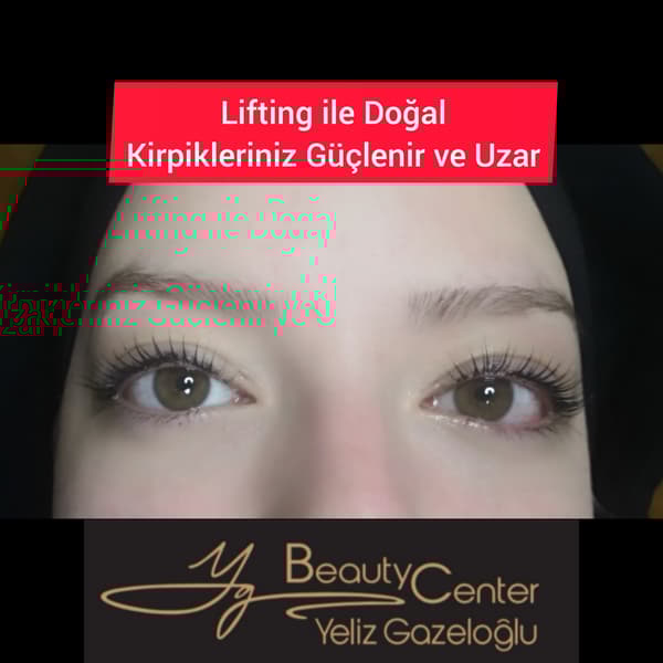 Yeliz Gazeloğlu Beauty Center - 100. Fotoğraf