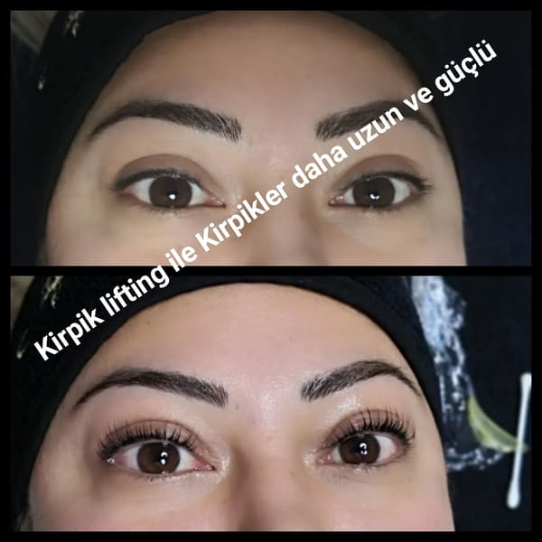 Yeliz Gazeloğlu Beauty Center - 63. Fotoğraf