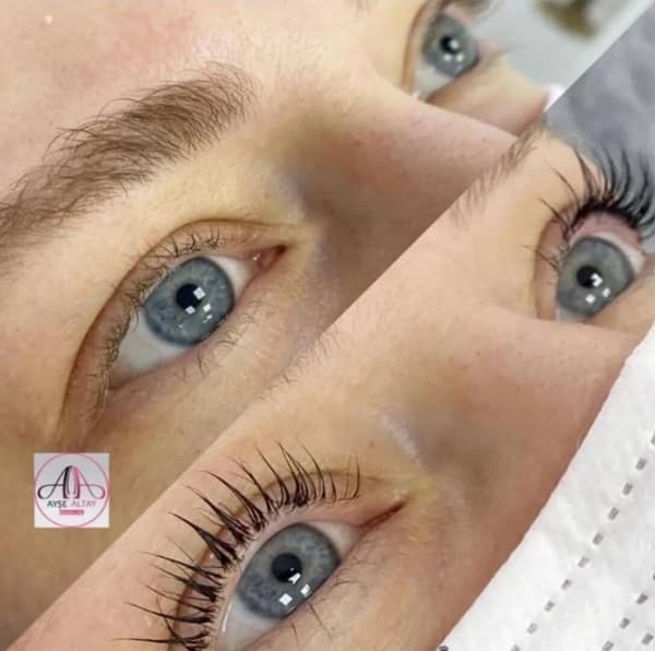 Ayşe Alya Güzellik Merkezi - 85. Fotoğraf Ayşe Alya Güzellik Merkezi - 85. Fotoğraf