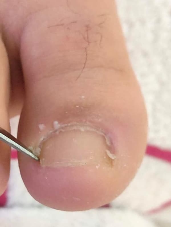 Ayşe Alya Güzellik Merkezi - 110. Fotoğraf Ayşe Alya Güzellik Merkezi - 110. Fotoğraf