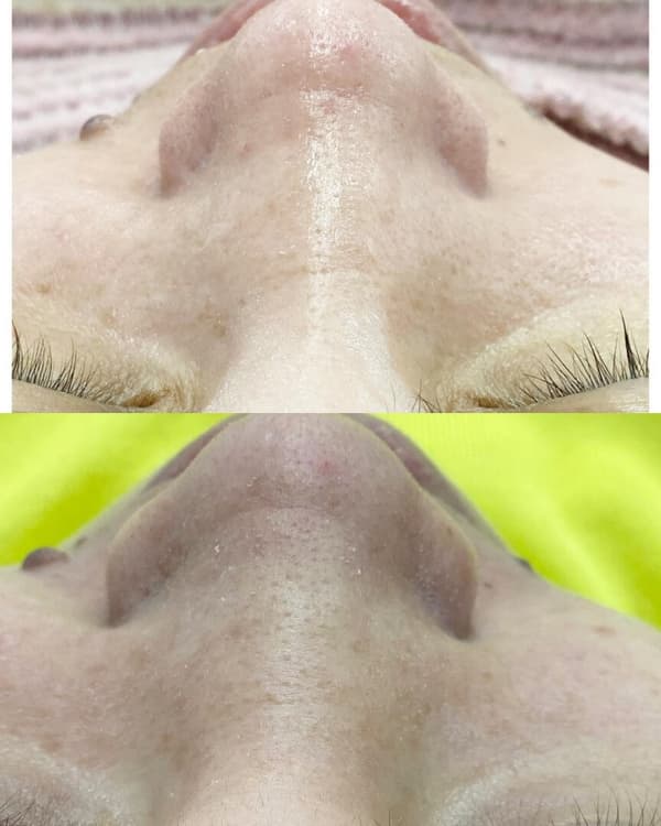 Ayşe Alya Güzellik Merkezi - 133. Fotoğraf Ayşe Alya Güzellik Merkezi - 133. Fotoğraf