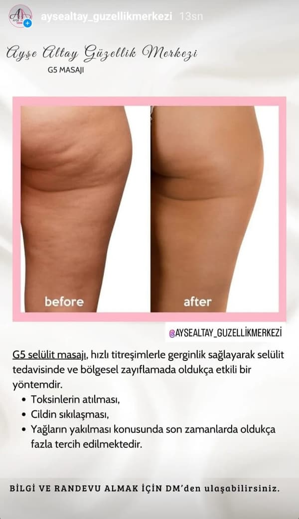 Ayşe Altay Güzellik Merkezi - 159. Fotoğraf