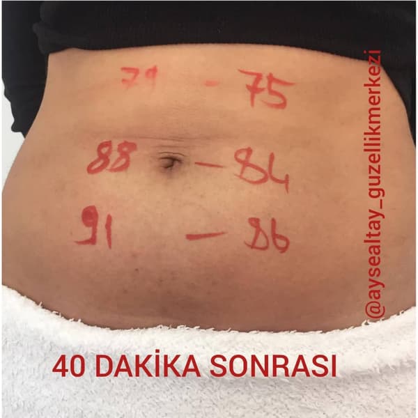 Ayşe Alya Güzellik Merkezi - 14. Fotoğraf Ayşe Alya Güzellik Merkezi - 14. Fotoğraf