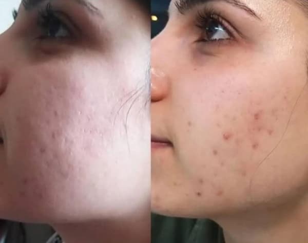 Ayşe Alya Güzellik Merkezi - 105. Fotoğraf Ayşe Alya Güzellik Merkezi - 105. Fotoğraf