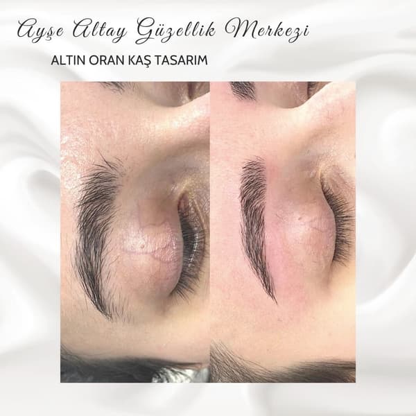 Ayşe Altay Güzellik Merkezi - 152. Fotoğraf