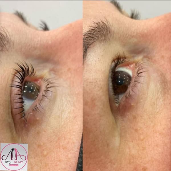 Ayşe Alya Güzellik Merkezi - 106. Fotoğraf Ayşe Alya Güzellik Merkezi - 106. Fotoğraf