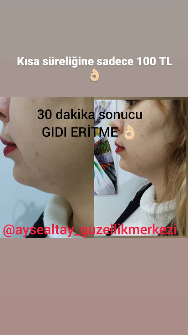 Ayşe Alya Güzellik Merkezi - 11. Fotoğraf Ayşe Alya Güzellik Merkezi - 11. Fotoğraf