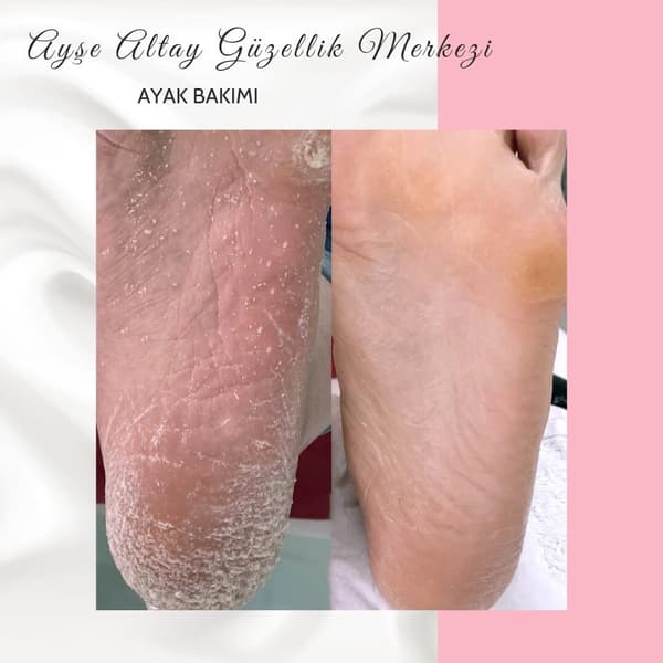 Ayşe Alya Güzellik Merkezi - 160. Fotoğraf Ayşe Alya Güzellik Merkezi - 160. Fotoğraf