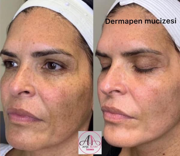 Ayşe Alya Güzellik Merkezi - 119. Fotoğraf Ayşe Alya Güzellik Merkezi - 119. Fotoğraf