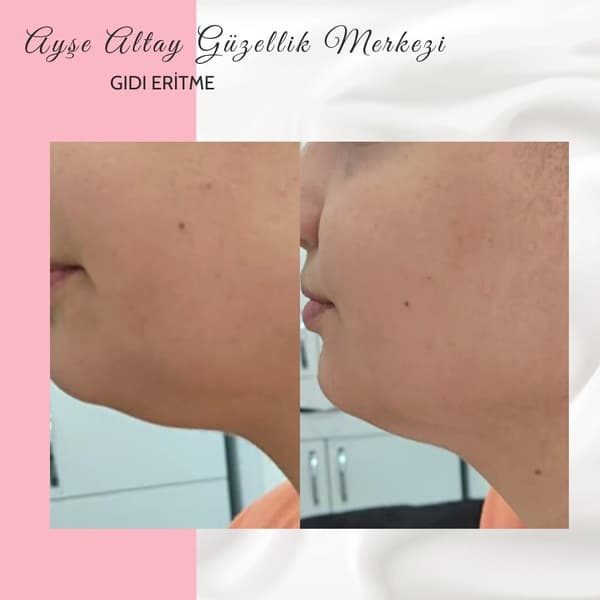 Ayşe Altay Güzellik Merkezi - 142. Fotoğraf