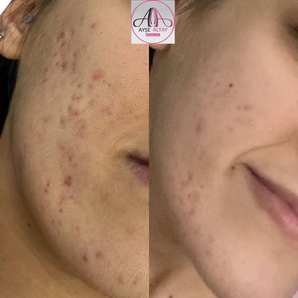 Ayşe Alya Güzellik Merkezi - 141. Fotoğraf Ayşe Alya Güzellik Merkezi - 141. Fotoğraf