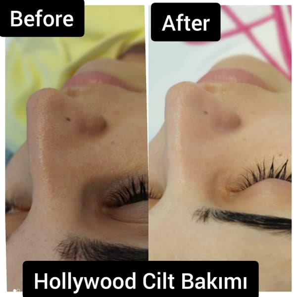 Ayşe Alya Güzellik Merkezi - 64. Fotoğraf Ayşe Alya Güzellik Merkezi - 64. Fotoğraf