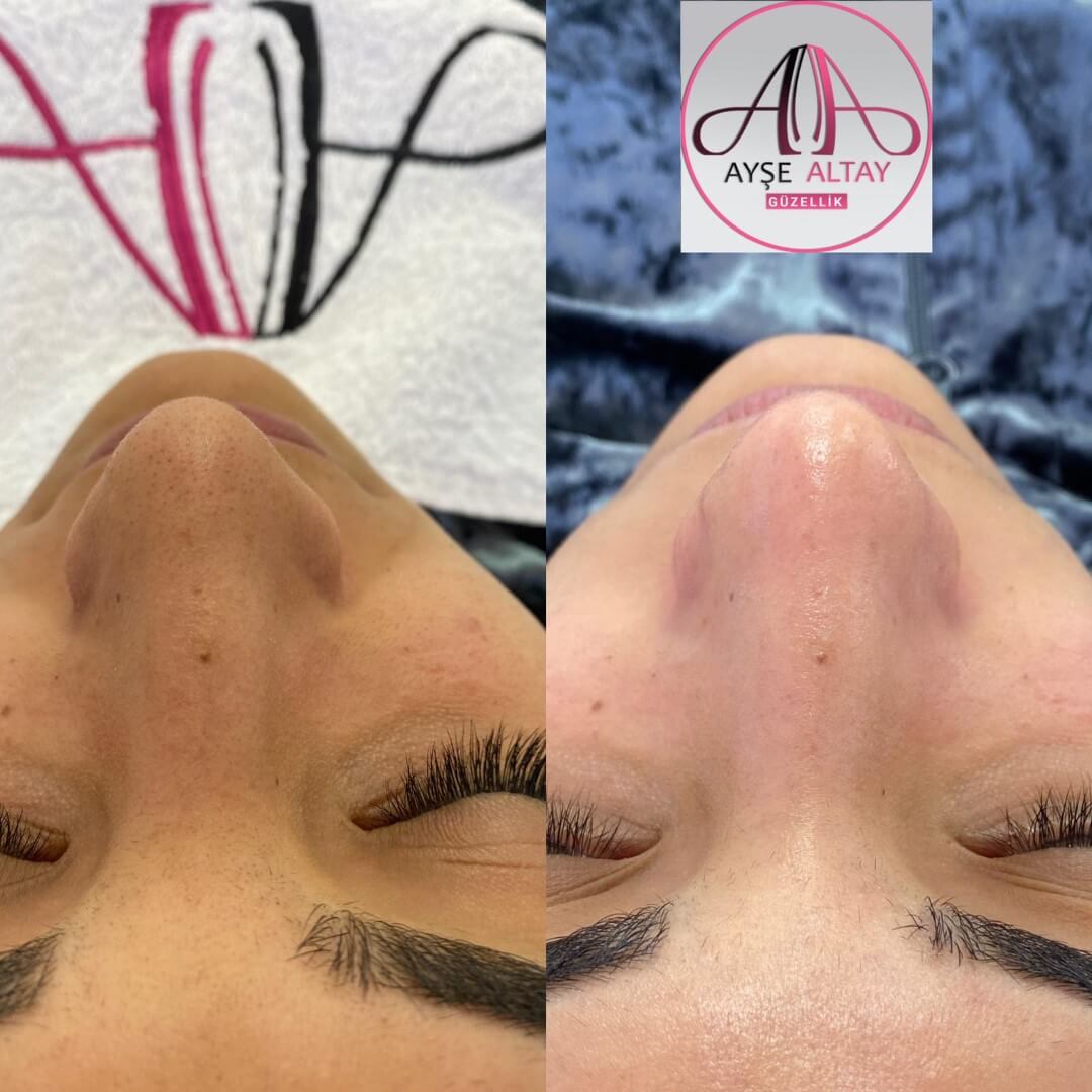 Ayşe Alya Güzellik Merkezi