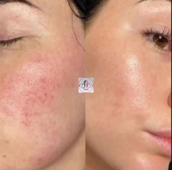 Ayşe Alya Güzellik Merkezi - 77. Fotoğraf Ayşe Alya Güzellik Merkezi - 77. Fotoğraf