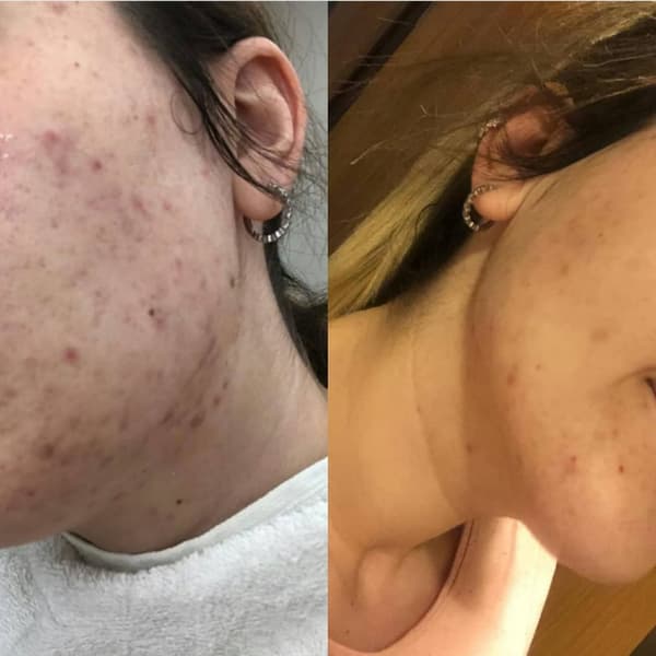 Ayşe Alya Güzellik Merkezi - 28. Fotoğraf Ayşe Alya Güzellik Merkezi - 28. Fotoğraf