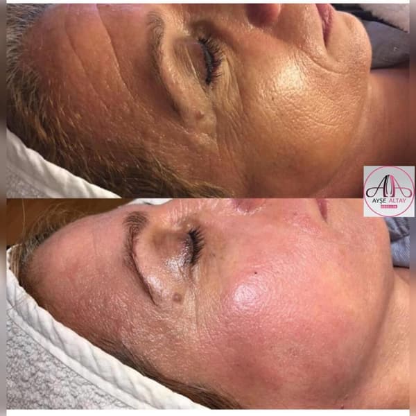 Ayşe Alya Güzellik Merkezi - 87. Fotoğraf Ayşe Alya Güzellik Merkezi - 87. Fotoğraf