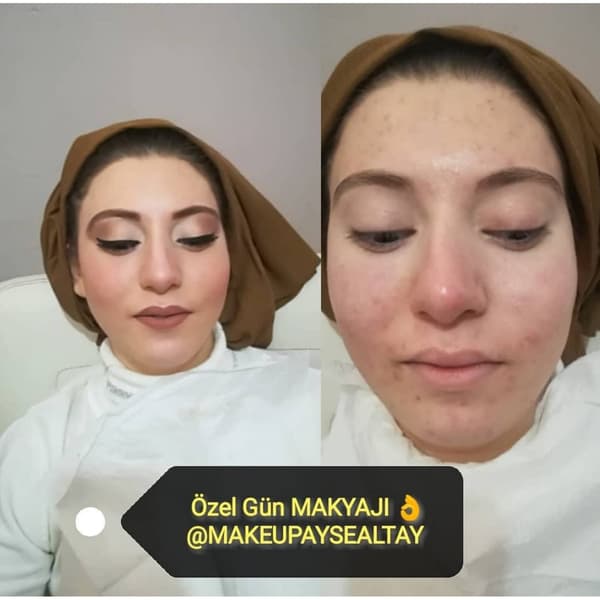 Ayşe Alya Güzellik Merkezi - 47. Fotoğraf Ayşe Alya Güzellik Merkezi - 47. Fotoğraf
