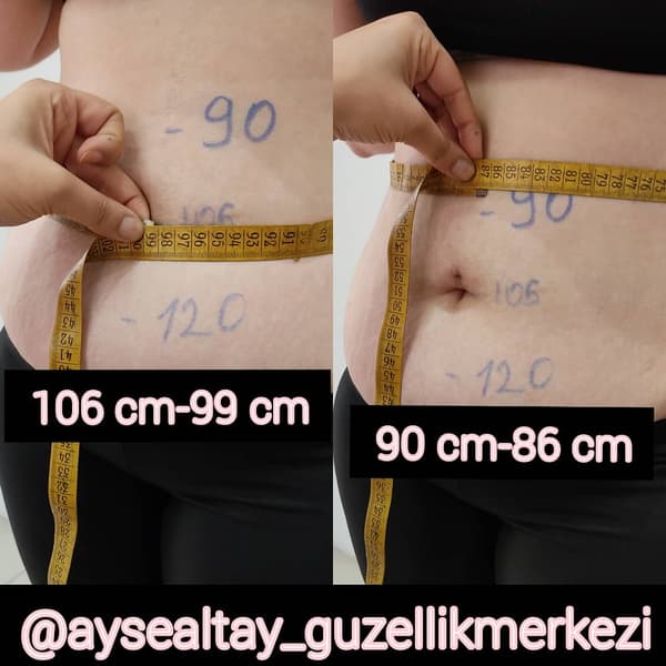 Ayşe Altay Güzellik Merkezi - 8. Fotoğraf