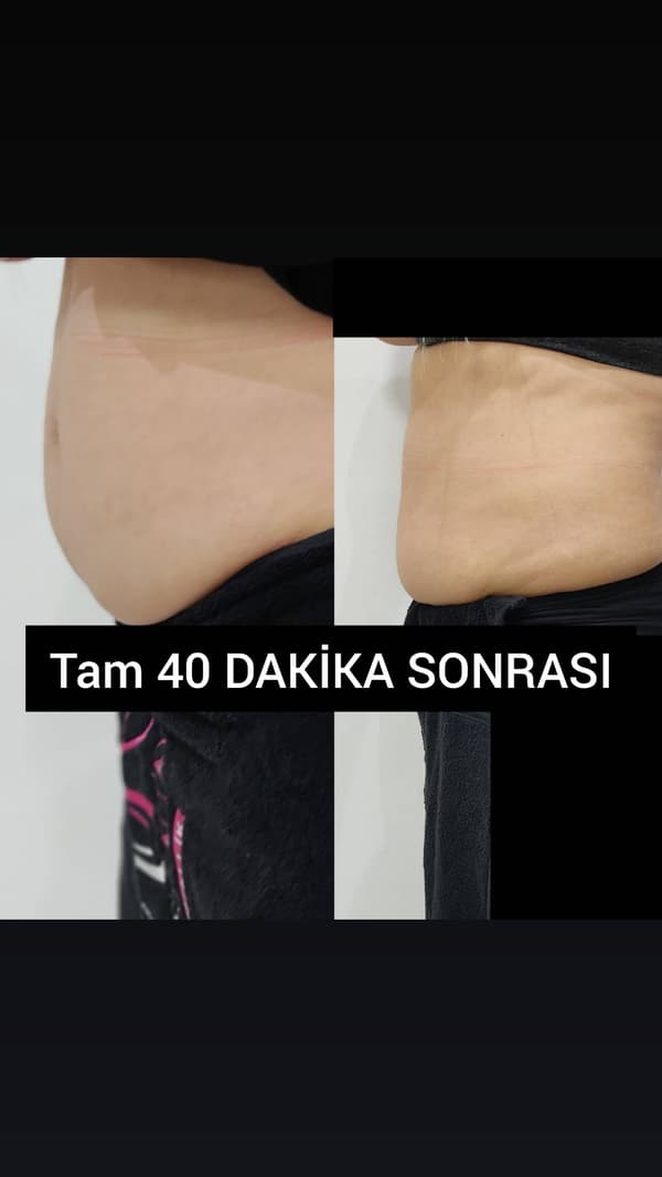 Ayşe Altay Güzellik Merkezi - 66. Fotoğraf