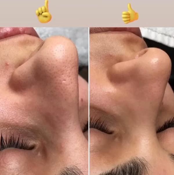 Ayşe Alya Güzellik Merkezi - 93. Fotoğraf Ayşe Alya Güzellik Merkezi - 93. Fotoğraf