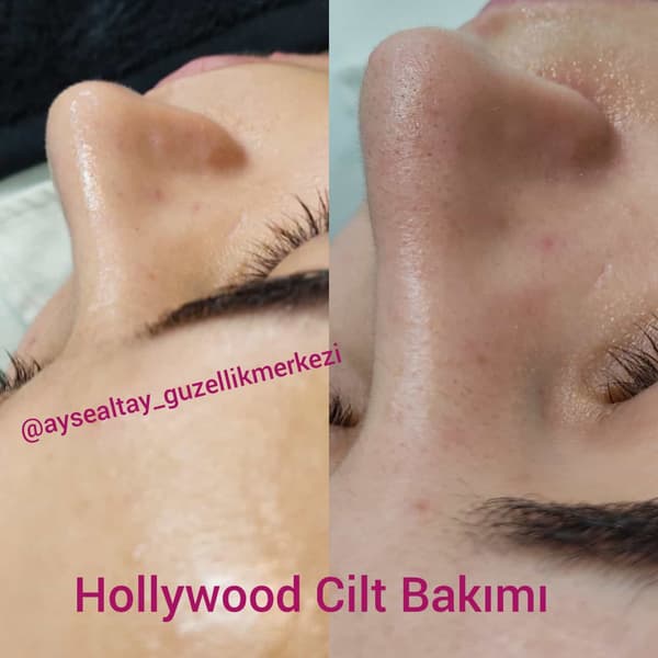 Ayşe Alya Güzellik Merkezi - 65. Fotoğraf Ayşe Alya Güzellik Merkezi - 65. Fotoğraf