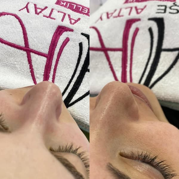 Ayşe Alya Güzellik Merkezi - 83. Fotoğraf Ayşe Alya Güzellik Merkezi - 83. Fotoğraf