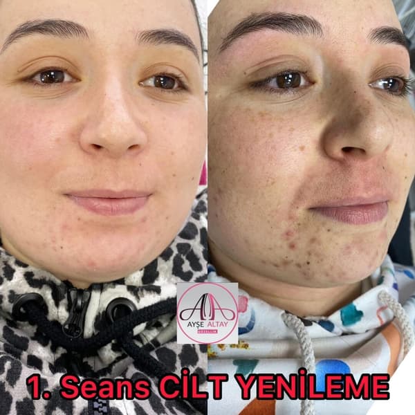 Ayşe Altay Güzellik Merkezi - 97. Fotoğraf
