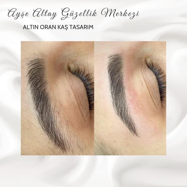 Ayşe Altay Güzellik Merkezi - 155. Fotoğraf